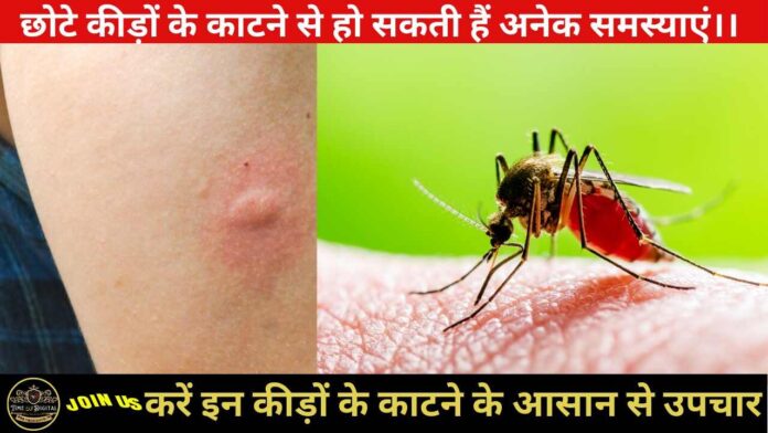 Small Insect Bites 2024 : छोटे कीड़ों के काटने से हो सकती हैं अनेक समस्याएं।। करें इन कीड़ों के काटने के आसान से उपचार